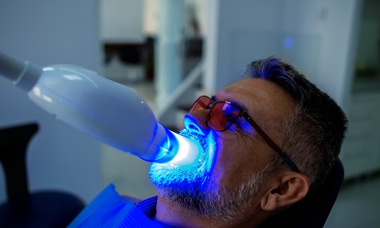 Jak przygotować się do zabiegu wybielania zębów?